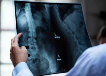 Unijorge oferece atendimento gratuito para avaliação e acompanhamento de pacientes com escoliose em Salvador